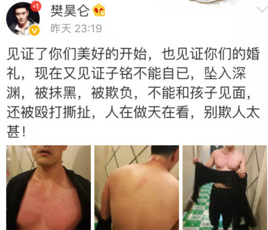 赫子铭和何洁离婚了吗 何洁家暴赫子铭是怎么回事